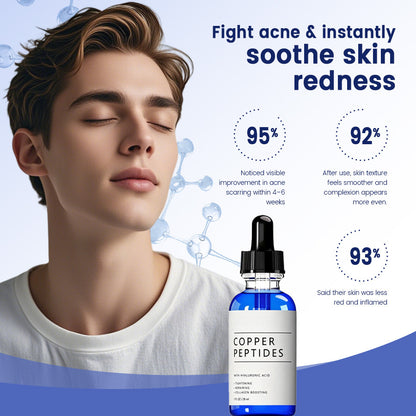 Copper Peptide Repair Serum (GHK-Cu Peptide and Hyaluronic Acid)