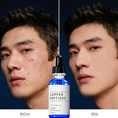 Copper Peptide Repair Serum (GHK-Cu Peptide and Hyaluronic Acid)